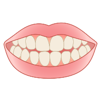 早坂瞬の口腔ケア(タップで記事へ📝)